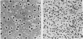 effect of inoculation on structure of ductile iron