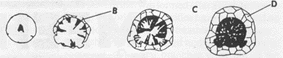 Fig.9 Graphite nodules form within gasbubbles